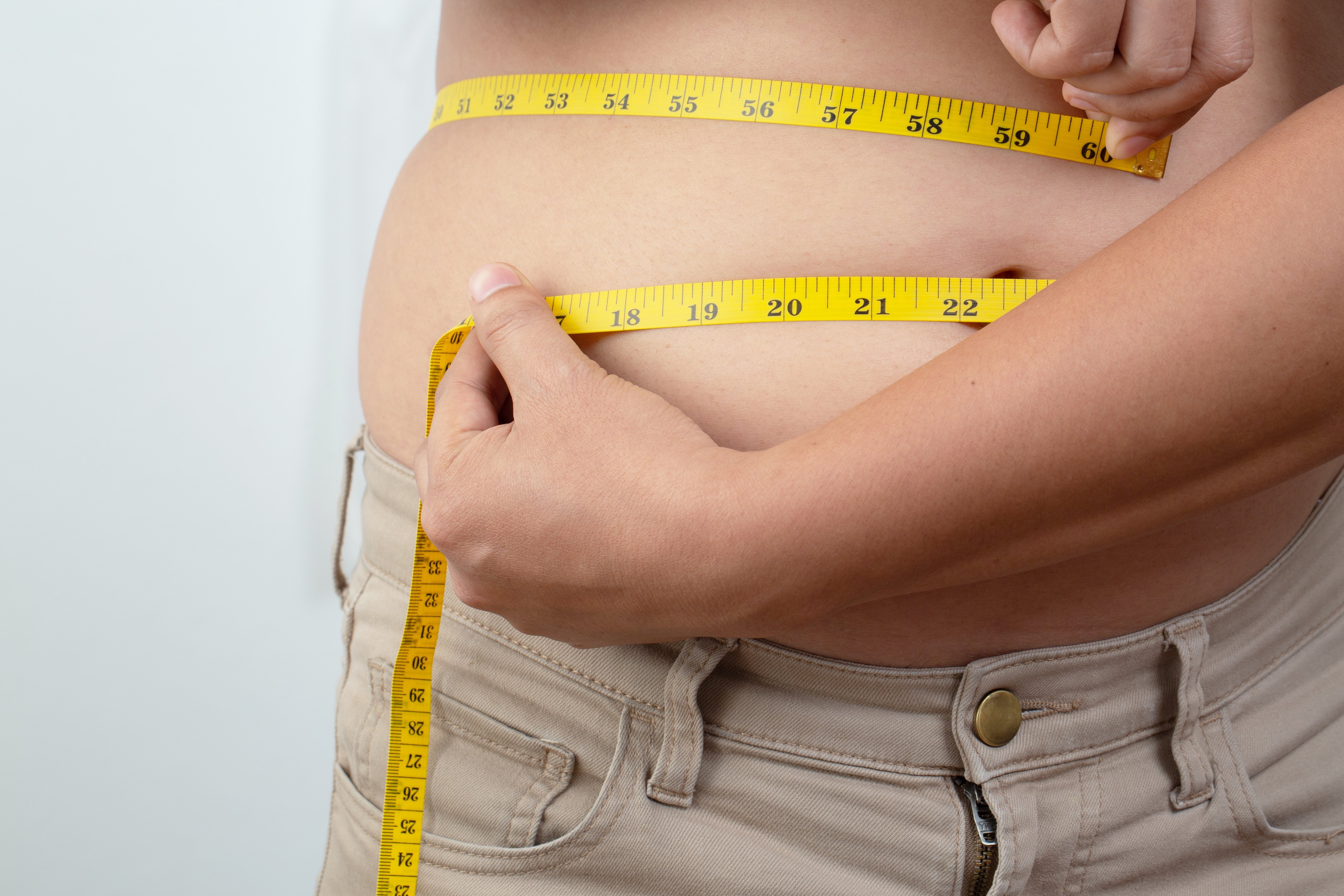 tratamiento para la obesidad