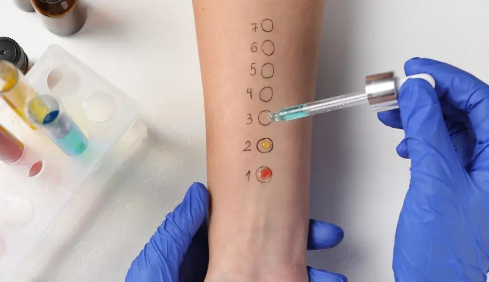 Tratamiento de base para alergias: claves clínicas de la inmunoterapia específica